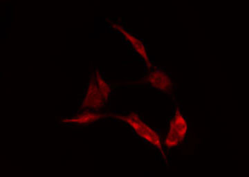 LGALS1 / Galectin 1 Antibody - Staining HeLa cells by IF/ICC. The samples were fixed with PFA and permeabilized in 0.1% Triton X-100, then blocked in 10% serum for 45 min at 25°C. The primary antibody was diluted at 1:200 and incubated with the sample for 1 hour at 37°C. An Alexa Fluor 594 conjugated goat anti-rabbit IgG (H+L) antibody, diluted at 1/600, was used as secondary antibody.