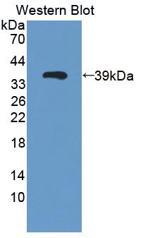 LGALS12 / Galectin 12 Antibody - Western blot of LGALS12 / Galectin 12 antibody.