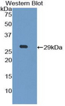 LGALS12 / Galectin 12 Antibody - Western blot of recombinant LGALS12 / Galectin 12.  This image was taken for the unconjugated form of this product. Other forms have not been tested.
