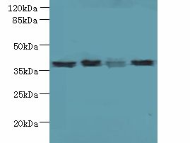 LGALS12 / Galectin 12 Antibody - Western blot. All lanes: LGALS12 antibody at 6 ug/ml. Lane 1: K562 whole cell lysate. Lane 2: MDA-MB-231 whole cell lysate. Lane 3: A431 whole cell lysate. Lane 4: MCF7 whole cell lysate. Secondary antibody: Goat polyclonal to Rabbit IgG at 1:10000 dilution. Predicted band size: 38 kDa. Observed band size: 38 kDa.