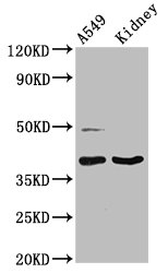 LGALS12 / Galectin 12 Antibody - Western Blot Positive WB detected in: A549 whole cell lysate, Rat kidney tissue All lanes: LGALS12 antibody at 3µg/ml Secondary Goat polyclonal to rabbit IgG at 1/50000 dilution Predicted band size: 38, 32, 37, 30, 36 kDa Observed band size: 38 kDa
