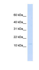 LGALS13 / Galectin 13 Antibody - LGALS13 / Galectin 3 antibody Western blot of Fetal Heart lysate. This image was taken for the unconjugated form of this product. Other forms have not been tested.