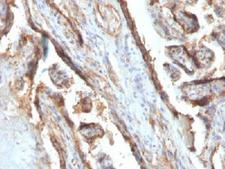 LGALS13 / Galectin 13 Antibody - IHC testing of FFPE human placenta with Galectin 13 antibody (clone PP13/1161). Required HIER: boil tissue sections in 10mM Tris with 1mM EDTA, pH 9 or 10mM Citrate buffer, pH 6, for 10-20.