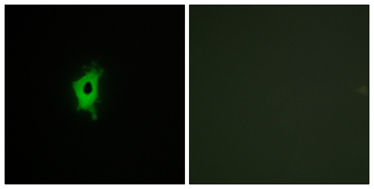 LGALS2 / Galectin 2 Antibody - Immunofluorescence analysis of COS7 cells, using LEG2 Antibody. The picture on the right is blocked with the synthesized peptide.