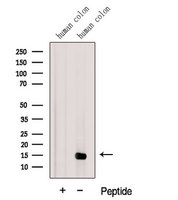 LGALS2 / Galectin 2 Antibody - Western blot analysis of extracts of human colon tissue using Galectin2 antibody. The lane on the left was treated with blocking peptide.