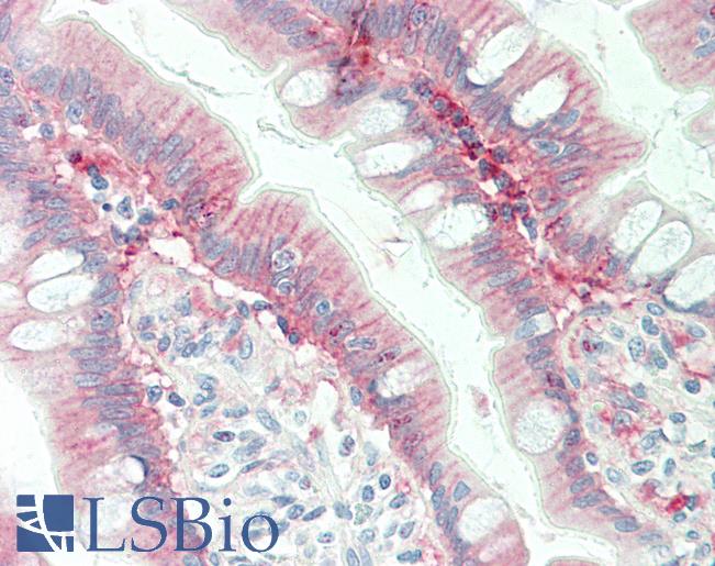 LGALS3 / Galectin 3 Antibody - Human Small Intestine: Formalin-Fixed, Paraffin-Embedded (FFPE)