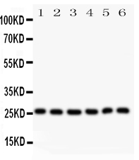 LGALS3 / Galectin 3 Antibody - Western blot analysis of Galectin-3 using anti-Galectin-3 antibody. Electrophoresis was performed on a 5-20% SDS-PAGE gel at 70V (Stacking gel) / 90V (Resolving gel) for 2-3 hours. The sample well of each lane was loaded with 50ug of sample under reducing conditions. Lane 1: Hela Whole Cell Lysate Lane 2: SGC Whole Cell Lysate Lane 3: MCF-7 Whole Cell Lysate Lane 4: SW620 Whole Cell Lysate Lane 5: A375 Whole Cell Lysate Lane 6: Smmc Whole Cell Lysate After Electrophoresis, proteins were transferred to a Nitrocellulose membrane at 150mA for 50-90 minutes. Blocked the membrane with 5% Non-fat Milk/ TBS for 1.5 hour at RT. The membrane was incubated with rabbit anti-Galectin-3 antigen affinity purified polyclonal antibody at 0.5 µg/mL overnight at 4°C, then washed with TBS-0.1% Tween 3 times with 5 minutes each and probed with a goat anti-rabbit IgG-HRP secondary antibody at a dilution of 1:10000 for 1.5 hour at RT. The signal is developed using an Enhanced Chemiluminescent detection (ECL) kit with Tanon 5200 system. A specific band was detected for Galectin-3 at approximately 26KD. The expected band size for Galectin-3 is at 26KD.