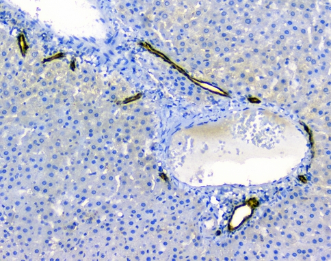 LGALS3 / Galectin 3 Antibody - IHC analysis of Galectin 3 using anti-Galectin 3 antibody. Galectin 3 was detected in paraffin-embedded section of rat liver tissues. Heat mediated antigen retrieval was performed in citrate buffer (pH6, epitope retrieval solution) for 20 mins. The tissue section was blocked with 10% goat serum. The tissue section was then incubated with 1µg/ml rabbit anti-Galectin 3 Antibody overnight at 4°C. Biotinylated goat anti-rabbit IgG was used as secondary antibody and incubated for 30 minutes at 37°C. The tissue section was developed using Strepavidin-Biotin-Complex (SABC) with DAB as the chromogen.