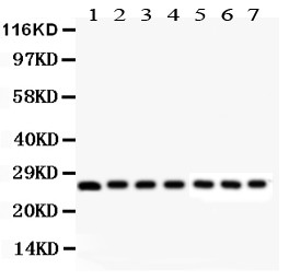 LGALS3 / Galectin 3 Antibody - Galectin3 antibody Western blot. All lanes: Anti Galectin3 at 0.5 ug/ml. Lane 1: Mouse Kidney Tissue Lysate at 50 ug. Lane 2: Mouse Liver Tissue Lysate at 50 ug. Lane 3: Mouse Spleen Tissue Lysate at 50 ug. Lane 4: Mouse Ovary Tissue Lysate at 50 ug. Lane 5: HEPA Whole Cell Lysate at 40 ug. Lane 6: ANA-1 Whole Cell Lysate at 40 ug. Lane 7: NIH3T3 Whole Cell Lysate at 40 ug. predicted band size: 26 kD. Observed band size: 26 kD.