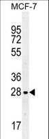 LGALS3 / Galectin 3 Antibody - LGALS3 Antibody western blot of MCF-7 cell line lysates (35 ug/lane). The LGALS3 antibody detected the LGALS3 protein (arrow).