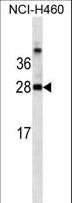 LGALS3 / Galectin 3 Antibody - LGALS3 Antibody western blot of NCI-H460 cell line lysates (35 ug/lane). The LGALS3 antibody detected the LGALS3 protein (arrow).
