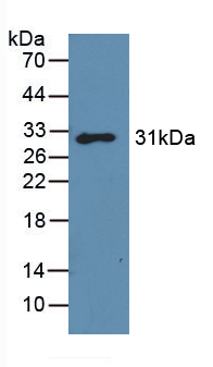 LGALS3 / Galectin 3 Antibody