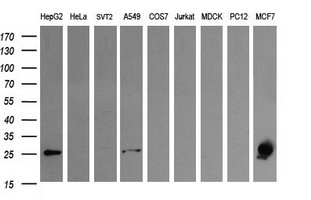 LGALS3 / Galectin 3 Antibody - Western blot of extracts (35ug) from 9 different cell lines by using anti-LGALS3 monoclonal antibody (HepG2: human; HeLa: human; SVT2: mouse; A549: human; COS7: monkey; Jurkat: human; MDCK: canine; PC12: rat; MCF7: human).