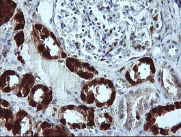 LGALS3 / Galectin 3 Antibody - IHC of paraffin-embedded Human Kidney tissue using anti-LGALS3 mouse monoclonal antibody. (Heat-induced epitope retrieval by 10mM citric buffer, pH6.0, 120°C for 3min).