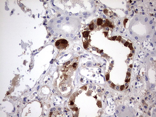 LGALS3 / Galectin 3 Antibody - IHC of paraffin-embedded Human Kidney tissue using anti-LGALS3 mouse monoclonal antibody. (Heat-induced epitope retrieval by 1 mM EDTA in 10mM Tris, pH8.5, 120°C for 3min).