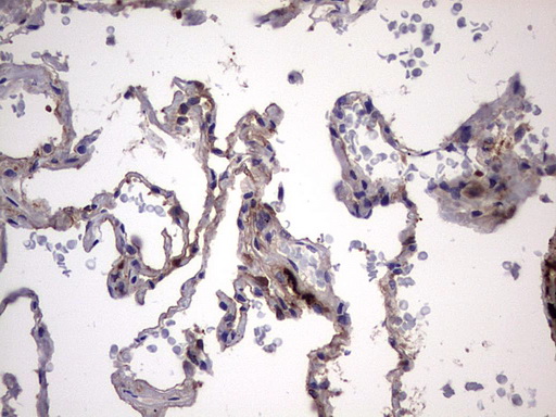 LGALS3 / Galectin 3 Antibody - IHC of paraffin-embedded Human lung tissue using anti-LGALS3 mouse monoclonal antibody. (Heat-induced epitope retrieval by 1 mM EDTA in 10mM Tris, pH8.5, 120°C for 3min).