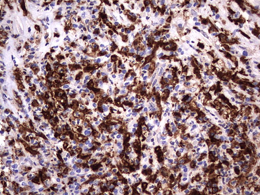 LGALS3 / Galectin 3 Antibody - IHC of paraffin-embedded Human lymph node tissue using anti-LGALS3 mouse monoclonal antibody. (Heat-induced epitope retrieval by 1 mM EDTA in 10mM Tris, pH8.5, 120°C for 3min).
