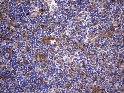 LGALS3 / Galectin 3 Antibody - IHC of paraffin-embedded Human tonsil using anti-LGALS3 mouse monoclonal antibody. (Heat-induced epitope retrieval by 1 mM EDTA in 10mM Tris, pH8.5, 120°C for 3min).