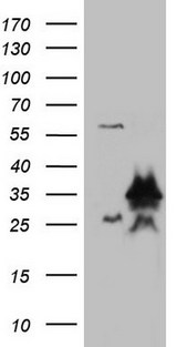 LGALS3 / Galectin 3 Antibody - HEK293T cells were transfected with the pCMV6-ENTRY control. (Left lane) or pCMV6-ENTRY LGALS3. (Right lane) cDNA for 48 hrs and lysed. Equivalent amounts of cell lysates. (5 ug per lane) were separated by SDS-PAGE and immunoblotted with anti-LGALS3.