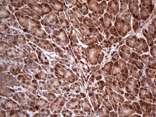 LGALS3 / Galectin 3 Antibody - Immunohistochemical staining of paraffin-embedded Human pancreas tissue within the normal limits using anti-LGALS3 mouse monoclonal antibody. (Heat-induced epitope retrieval by 1 mM EDTA in 10mM Tris, pH8.5, 120C for 3min,