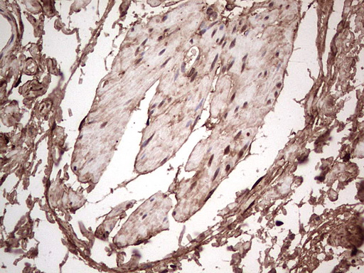 LGALS3 / Galectin 3 Antibody - Immunohistochemical staining of paraffin-embedded Human bladder tissue within the normal limits using anti-LGALS3 mouse monoclonal antibody. (Heat-induced epitope retrieval by 1 mM EDTA in 10mM Tris, pH8.5, 120C for 3min,