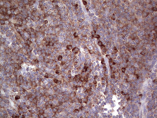 LGALS3 / Galectin 3 Antibody - Immunohistochemical staining of paraffin-embedded Human tonsil within the normal limits using anti-LGALS3 mouse monoclonal antibody. (Heat-induced epitope retrieval by 1 mM EDTA in 10mM Tris, pH8.5, 120C for 3min,