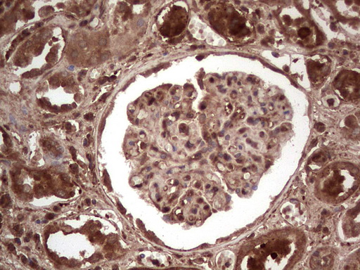 LGALS3 / Galectin 3 Antibody - Immunohistochemical staining of paraffin-embedded Human Kidney tissue within the normal limits using anti-LGALS3 mouse monoclonal antibody. (Heat-induced epitope retrieval by 1 mM EDTA in 10mM Tris, pH8.5, 120C for 3min,