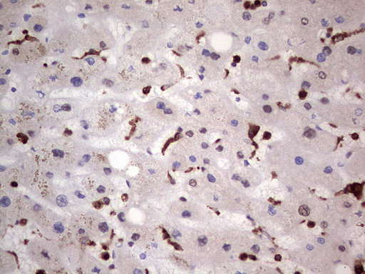 LGALS3 / Galectin 3 Antibody - Immunohistochemical staining of paraffin-embedded Human liver tissue within the normal limits using anti-LGALS3 mouse monoclonal antibody. (Heat-induced epitope retrieval by 1 mM EDTA in 10mM Tris, pH8.5, 120C for 3min,