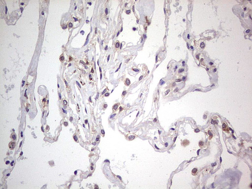 LGALS3 / Galectin 3 Antibody - Immunohistochemical staining of paraffin-embedded Human lung tissue within the normal limits using anti-LGALS3 mouse monoclonal antibody. (Heat-induced epitope retrieval by 1 mM EDTA in 10mM Tris, pH8.5, 120C for 3min,