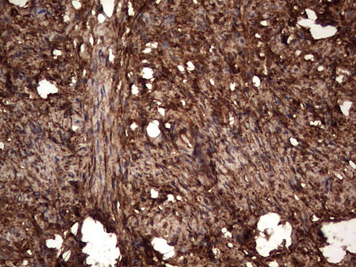 LGALS3 / Galectin 3 Antibody - Immunohistochemical staining of paraffin-embedded Human Ovary tissue within the normal limits using anti-LGALS3 Mouse monoclonal antibody.  heat-induced epitope retrieval by 1 mM EDTA in 10mM Tris, pH8.5, 120C for 3min)