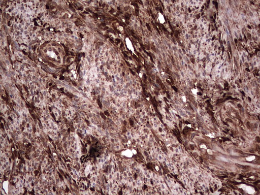 LGALS3 / Galectin 3 Antibody - Immunohistochemical staining of paraffin-embedded Human endometrium tissue within the normal limits using anti-LGALS3 Mouse monoclonal antibody.  heat-induced epitope retrieval by 1 mM EDTA in 10mM Tris, pH8.5, 120C for 3min)