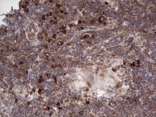 LGALS3 / Galectin 3 Antibody - Immunohistochemical staining of paraffin-embedded Human lymph node tissue within the normal limits using anti-LGALS3 Mouse monoclonal antibody.  heat-induced epitope retrieval by 1 mM EDTA in 10mM Tris, pH8.5, 120C for 3min)