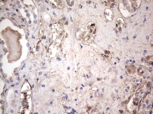 LGALS3 / Galectin 3 Antibody - Immunohistochemical staining of paraffin-embedded Human Kidney tissue within the normal limits using anti-LGALS3 Mouse monoclonal antibody.  heat-induced epitope retrieval by 1 mM EDTA in 10mM Tris, pH8.5, 120C for 3min)