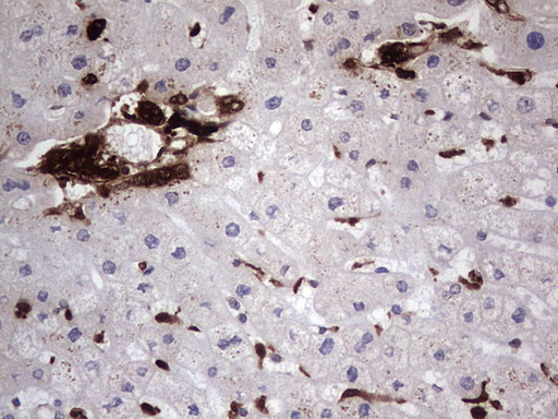 LGALS3 / Galectin 3 Antibody - Immunohistochemical staining of paraffin-embedded Human liver tissue within the normal limits using anti-LGALS3 Mouse monoclonal antibody.  heat-induced epitope retrieval by 1 mM EDTA in 10mM Tris, pH8.5, 120C for 3min)