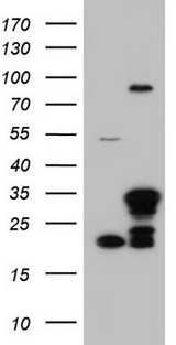 LGALS3 / Galectin 3 Antibody - HEK293T cells were transfected with the pCMV6-ENTRY control (Left lane) or pCMV6-ENTRY LGALS3 (Right lane) cDNA for 48 hrs and lysed. Equivalent amounts of cell lysates (5 ug per lane) were separated by SDS-PAGE and immunoblotted with anti-LGALS3.