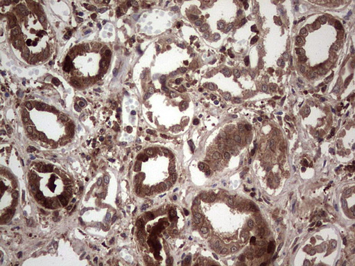 LGALS3 / Galectin 3 Antibody - IHC of paraffin-embedded Human Kidney tissue using anti-LGALS3 mouse monoclonal antibody. (Heat-induced epitope retrieval by 1 mM EDTA in 10mM Tris, pH8.5, 120°C for 3min).