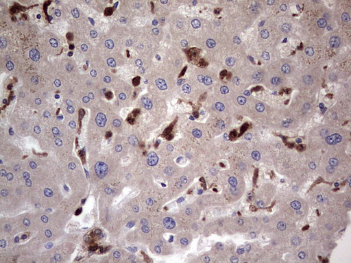 LGALS3 / Galectin 3 Antibody - IHC of paraffin-embedded Human liver tissue using anti-LGALS3 mouse monoclonal antibody. (Heat-induced epitope retrieval by 1 mM EDTA in 10mM Tris, pH8.5, 120°C for 3min).