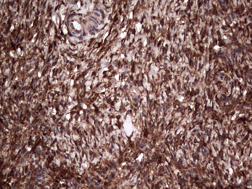 LGALS3 / Galectin 3 Antibody - IHC of paraffin-embedded Human Ovary tissue using anti-LGALS3 mouse monoclonal antibody. (Heat-induced epitope retrieval by 1 mM EDTA in 10mM Tris, pH8.5, 120°C for 3min).