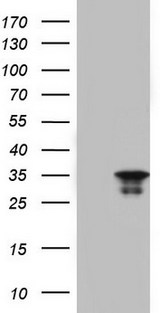 LGALS3 / Galectin 3 Antibody - HEK293T cells were transfected with the pCMV6-ENTRY control. (Left lane) or pCMV6-ENTRY LGALS3. (Right lane) cDNA for 48 hrs and lysed. Equivalent amounts of cell lysates. (5 ug per lane) were separated by SDS-PAGE and immunoblotted with anti-LGALS3.