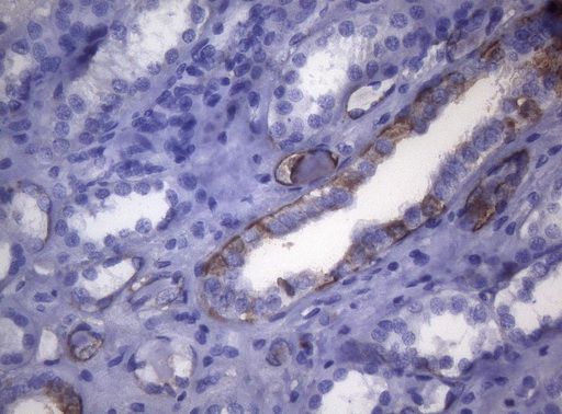 LGALS3 / Galectin 3 Antibody - Immunohistochemical staining of paraffin-embedded Human Kidney tissue within the normal limits using anti-LGALS3 mouse monoclonal antibody. (Heat-induced epitope retrieval by 1mM EDTA in 10mM Tris buffer. (pH8.5) at 120°C for 3 min. (1:150)