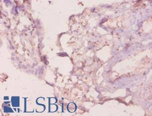 LGALS3 / Galectin 3 Antibody - Immunohistochemistry of paraffin-embedded human placenta using MAC-2 / Galectin 3 antibody at dilution of 1:20.  This image was taken for the unconjugated form of this product. Other forms have not been tested.