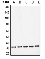 LGALS3 / Galectin 3 Antibody - Western blot analysis of Galectin 3 expression in HeLa (A); Jurkat (B); Raw264.7 (C); mouse liver (D); rat liver (E) whole cell lysates.
