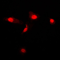LGALS3 / Galectin 3 Antibody - Immunofluorescent analysis of Galectin 3 staining in Jurkat cells. Formalin-fixed cells were permeabilized with 0.1% Triton X-100 in TBS for 5-10 minutes and blocked with 3% BSA-PBS for 30 minutes at room temperature. Cells were probed with the primary antibody in 3% BSA-PBS and incubated overnight at 4 C in a humidified chamber. Cells were washed with PBST and incubated with a DyLight 594-conjugated secondary antibody (red) in PBS at room temperature in the dark. DAPI was used to stain the cell nuclei (blue).