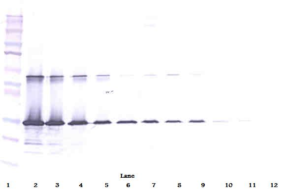 LGALS3 / Galectin 3 Antibody - Anti-Human Galectin-3 Western Blot Unreduced