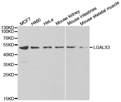 LGALS3 / Galectin 3 Antibody - Western blot analysis of extracts of various cell lines, using LGALS3 antibody.