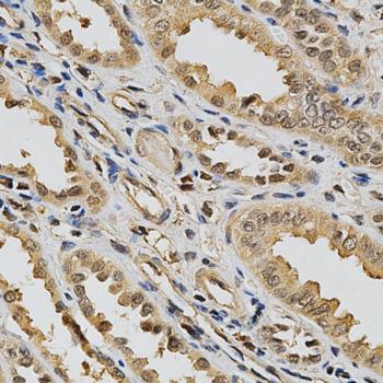 LGALS3 / Galectin 3 Antibody - Immunohistochemistry of formalin-fixed paraffin-embedded (FFPE) human kidney using LGALS3 antibody at dilution of 1:200 (40x magnification).