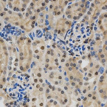 LGALS3 / Galectin 3 Antibody - Immunohistochemistry of paraffin-embedded mouse kidney using LGALS3 Antibodyat dilution of 1:200 (40x lens).