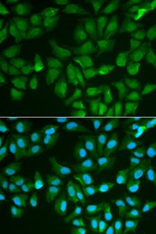 LGALS3 / Galectin 3 Antibody - Immunofluorescence analysis of MCF-7 cells using LGALS3 antibody. Blue: DAPI for nuclear staining.