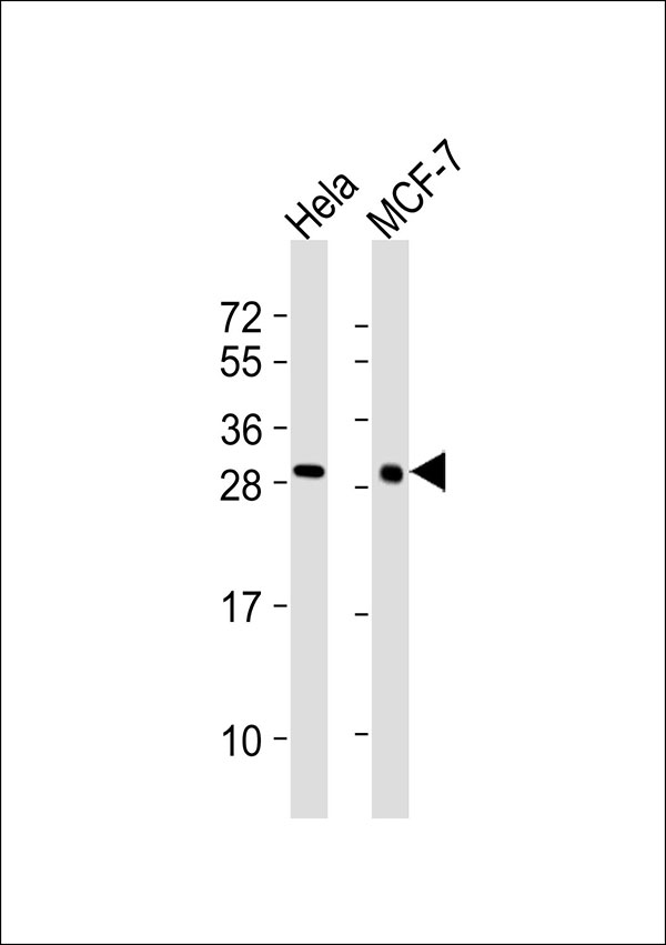LGALS3 / Galectin 3 Antibody - All lanes : Anti-Galectin 3 Antibody at 1:1000 dilution Lane 1: HeLa whole cell lysates Lane 2: MCF-7 whole cell lysates Lysates/proteins at 20 ug per lane. Secondary Goat Anti-Rabbit IgG, (H+L),Peroxidase conjugated at 1/10000 dilution Predicted band size : 31 kDa Blocking/Dilution buffer: 5% NFDM/TBST.