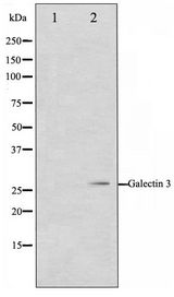 LGALS3 / Galectin 3 Antibody - Western blot of HeLa cell lysate using Galectin 3 Antibody